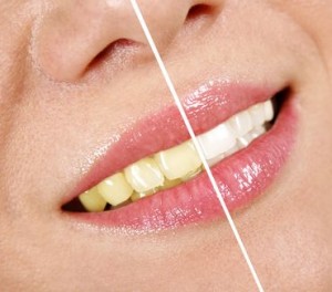 Mom S Spaghetti Remix Cracked Tooth Mom S Spaghetti Remix Cracked Tooth